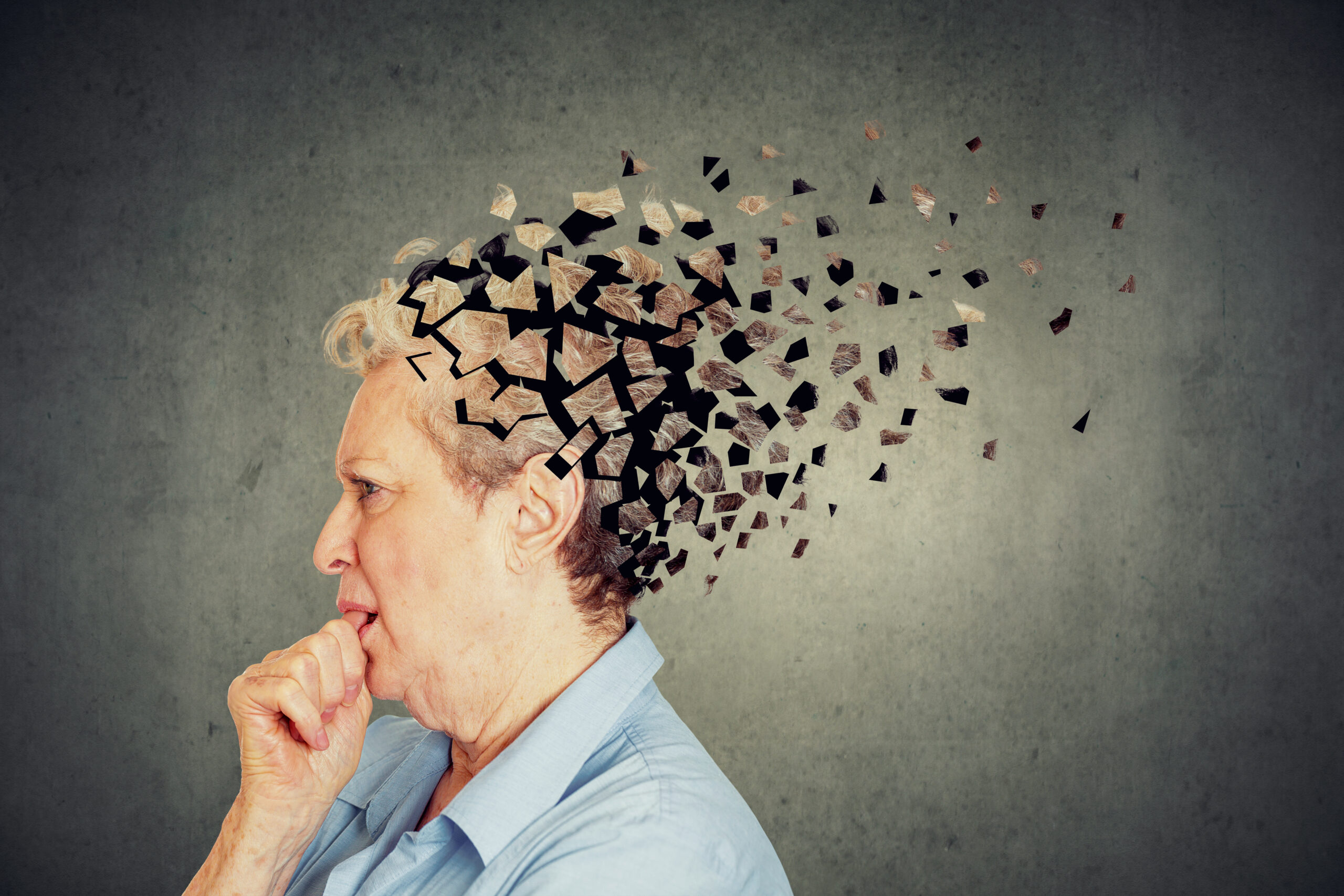 Principales Síntomas del Alzheimer